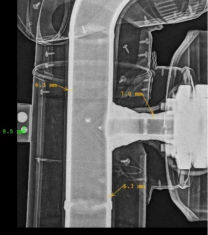 Digital radiograph of a pipe weld displayed on screen